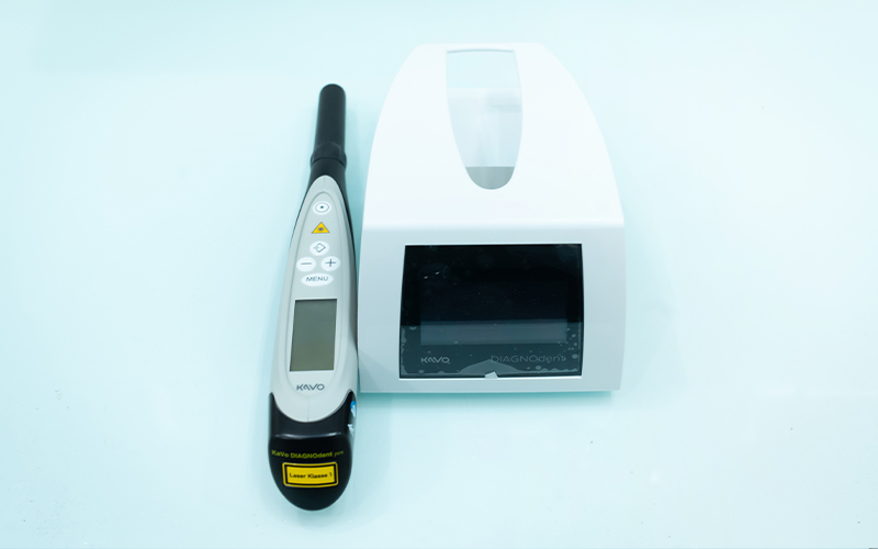 光学式う蝕検出装置ダイアグノデント