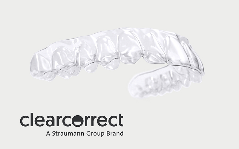 マウスピース矯正