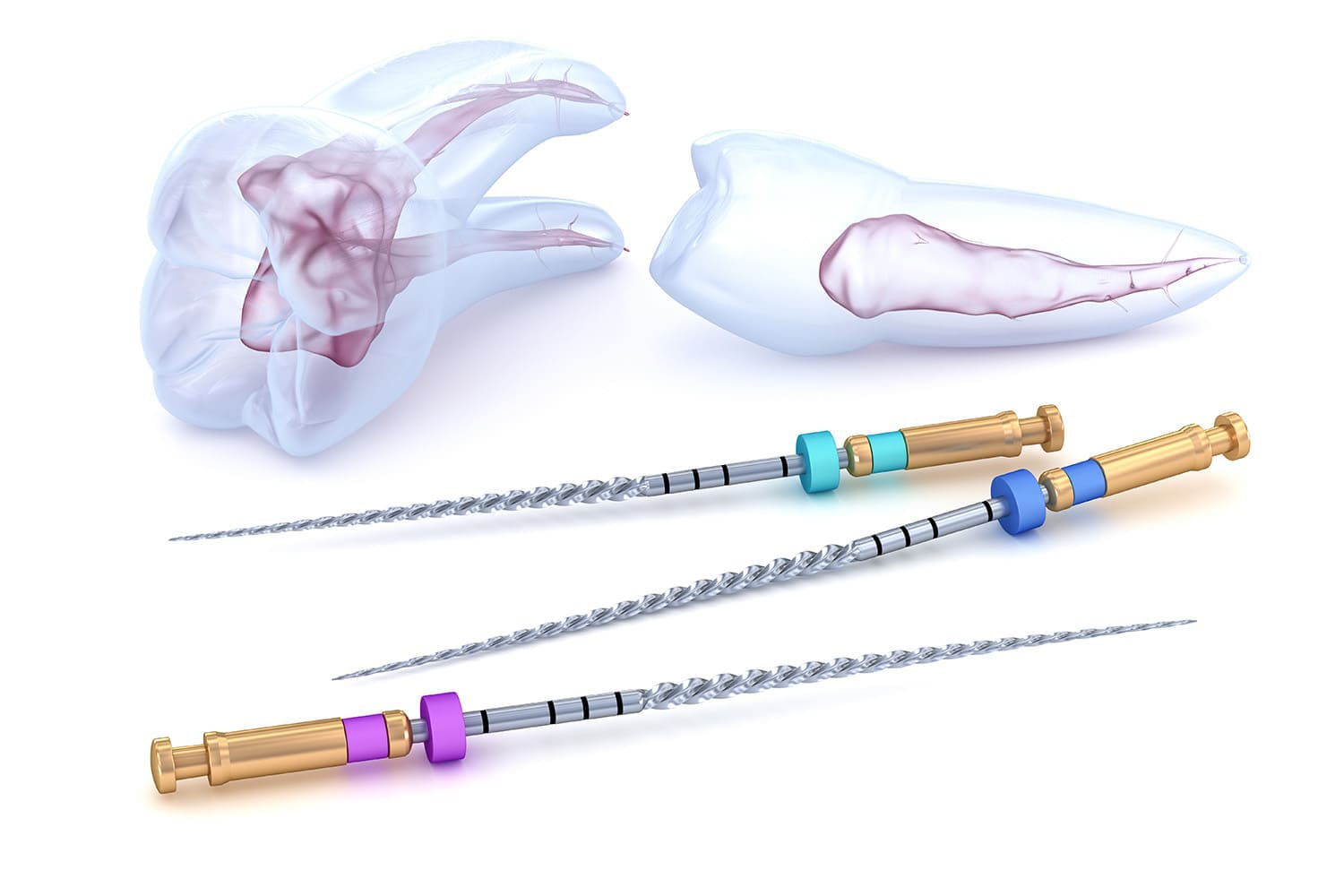 複雑な根にも対応できる「ニッケルチタンファイル」